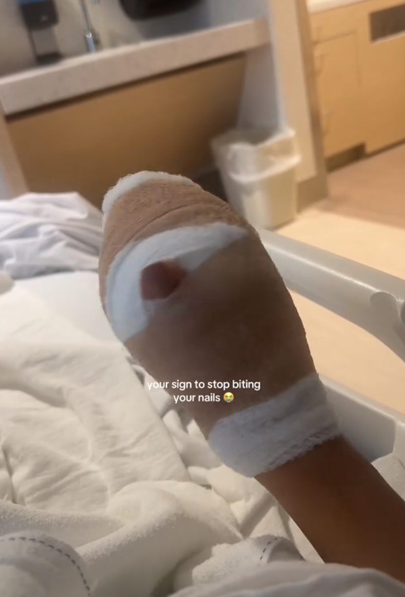 Bandaged hand of woman in hospital